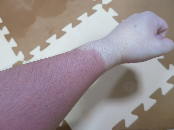 日焼け対策が必要